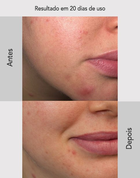 Kit Skincare Completão